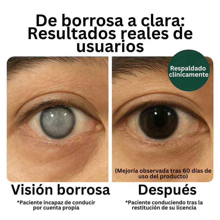 VisioZen – Ojos sin fatiga, visión clara
