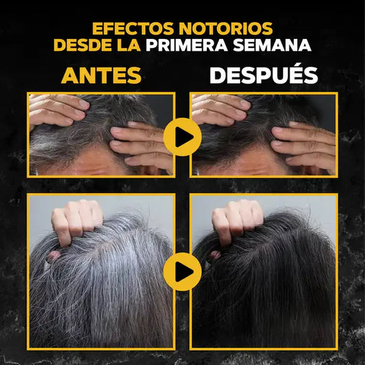 ByeCanas